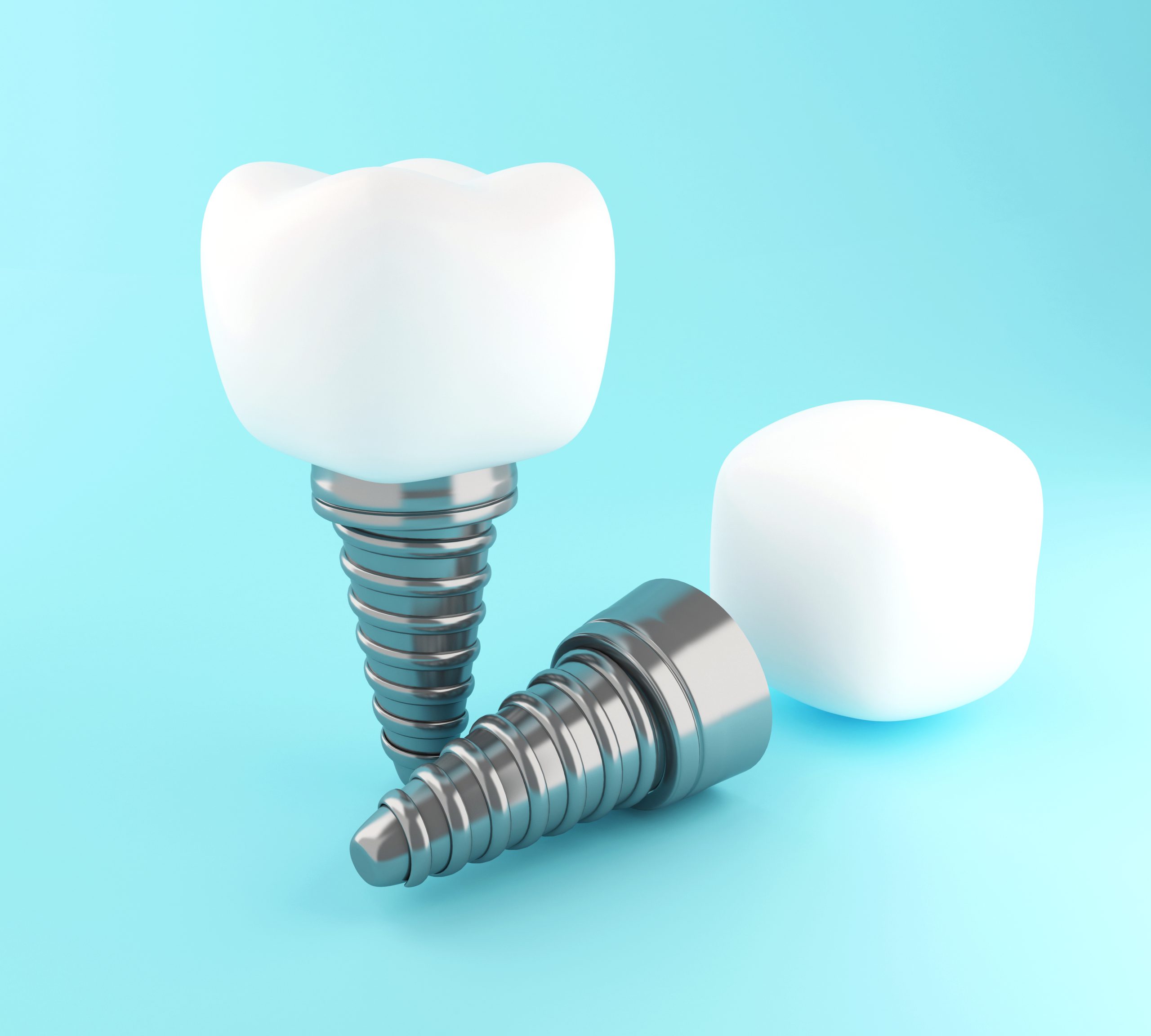 Dental İmplant Nedir?
