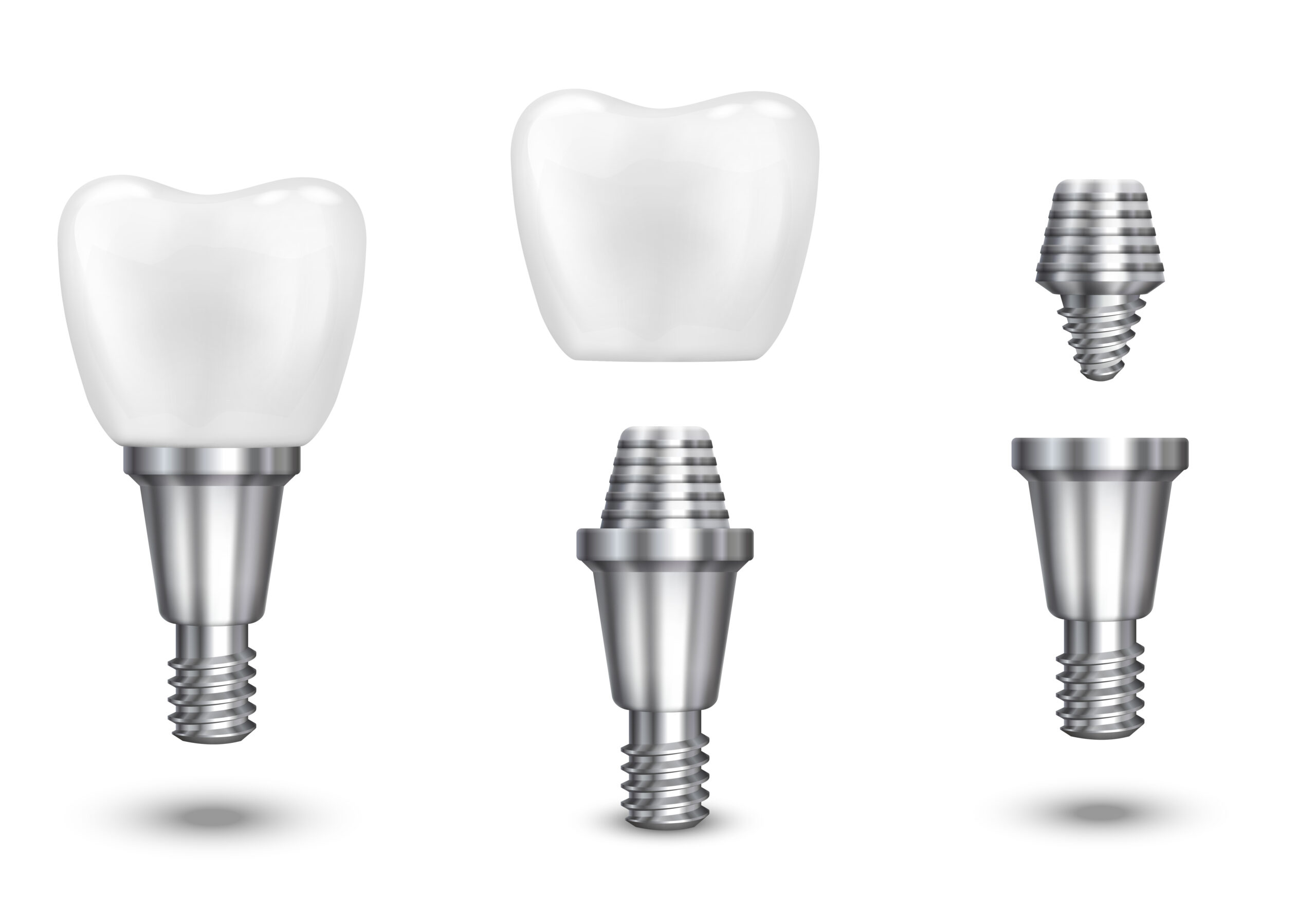 Dental İmplant Teknolojileri