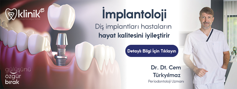 İmptlant Fiyatları 2023