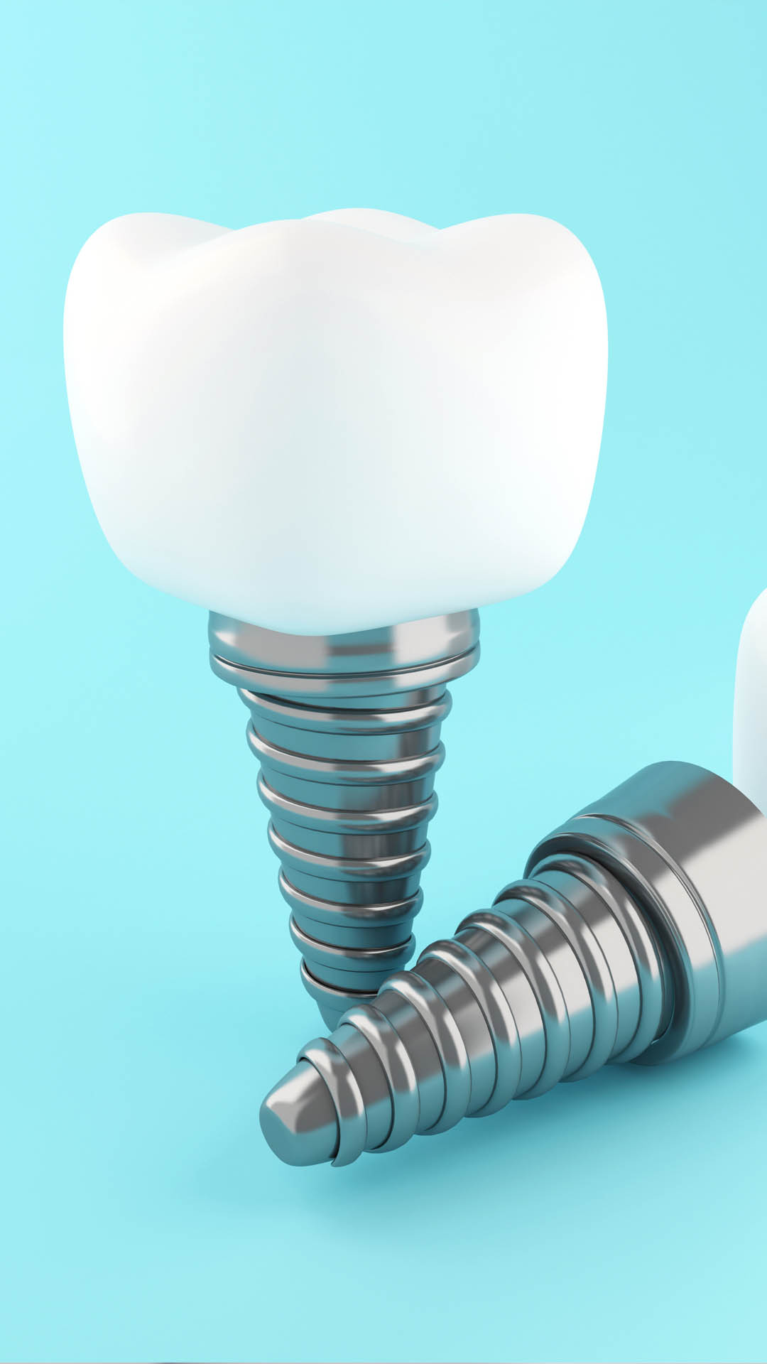 Implant Tedavisi Nedir?
